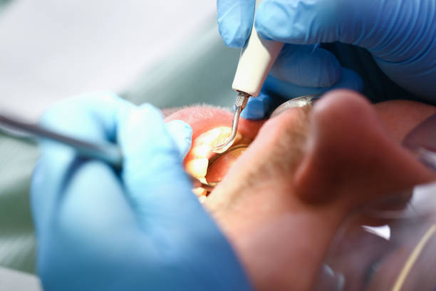 Best Cosmetic Emergency Dentistry in Waterloo, IN