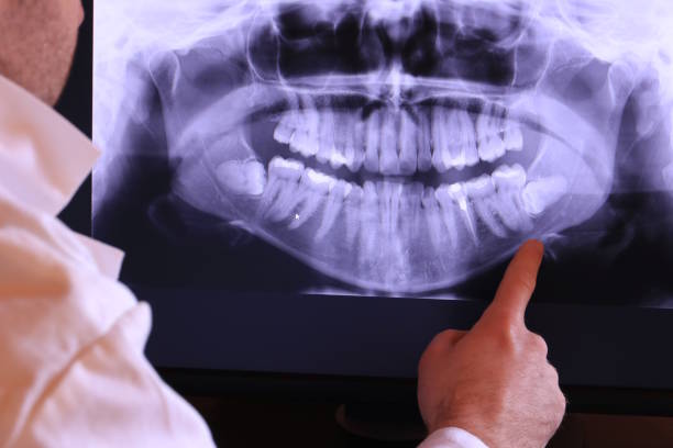 Best Pediatric Emergency Dentist in Waterloo, IN